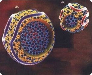 HDL-LDL